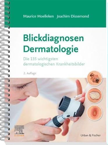 Blickdiagnosen Dermatologie: Die 135 wichtigsten dermatologischen Krankheitsbilder