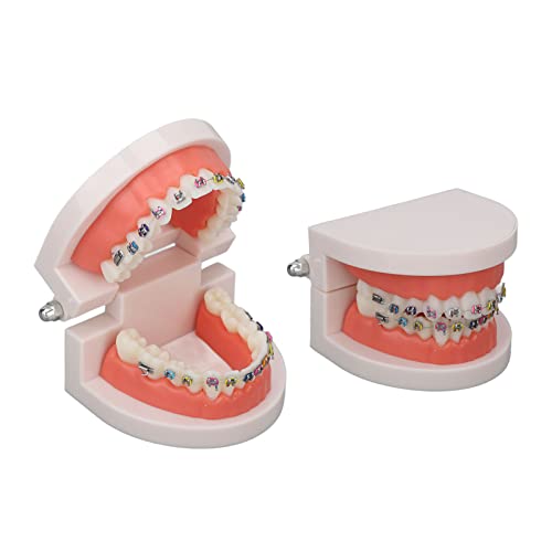 HUAOSN 2-teiliges Zahnzahnmodell mit Metallhalterung, Demonstration Typodont Standard-Zahnputzmodell Kieferorthopädie für Den Unterricht und Das Studium