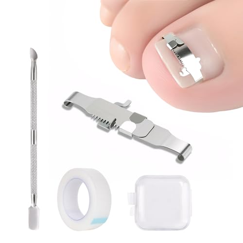 Eingewachsene Zehennägel Set, Eingewachsene Zehennagel Fixer Premium Edelstahl Maniküre Pediküre Set Für Eingewachsene Paronychie-Behandlung (S)