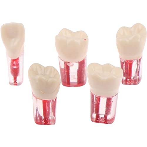 5 Stücke Harz Dental Endodontie Zahn Modell Endo Wurzelkanal Dateien Zellstoff Praxis Studie Endo Ausbildung Zahn RCT Demo Student Lehre