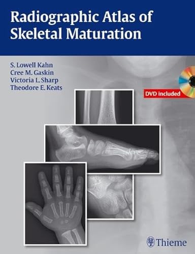 Radiographic Atlas of Skeletal Maturation: With Online Resource