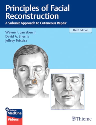 Principles of Facial Reconstruction