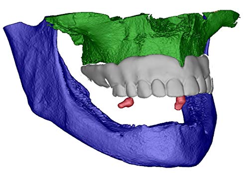 Röntgenkugel aus bariumsulfathaltigem Kunststoff für CT, DVT (25)