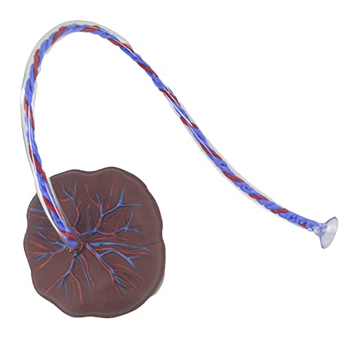 Nabelschnur-Modell - Neonatale Nabelschnur Placenta Modell - mit Venen Arterial Display, für Gynäkologie, medizinische Bildungshilfe (A)