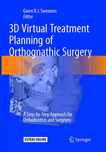 3D Virtual Treatment Planning of Orthognathic Surgery: A Step-by-Step Approach for Orthodontists and Surgeons