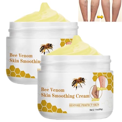 2 Stück Bienengift Krampfadern Creme, Furzero Krampfadern Creme, Varicose Veins Cream,Bienengift Schmerzcreme Bienengiftsalbe,für Jedermann