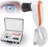 Hochauflösende Iris-Analysekamera mit einstellbarem Fokus für diagnostische Augenuntersuchung