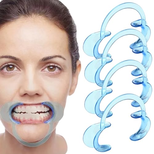 C-Form Mundöffner,Dental C-Form Mundöffner,Mundöffner Challenge,Wangenhalter,Mundwinkelhalter,für Orale Untersuchung, Behandlung, Zahnaufhellung