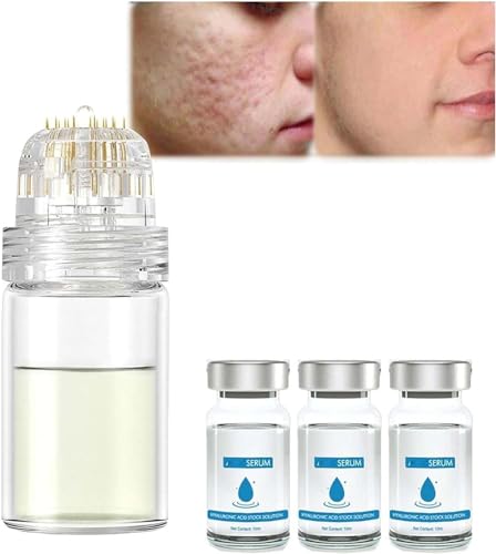 Mikro-Infusionssystem für Lippen, Mikrosystem für Gesicht, Gesichtssystem mit Serum, Mikro-Infusions-Gesichtssystem, Mikro-Infusionssystem für Gesicht, für alle Hauttypen (3