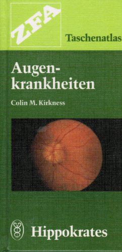 Augenkrankheiten