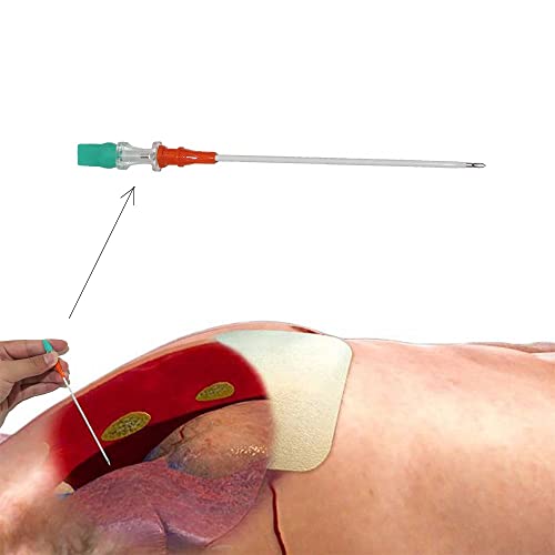 Pneumothorax Nadel Trauma Medical IFAK Chest Cathether Needle Militar 14G Thoracic Depensation Needle