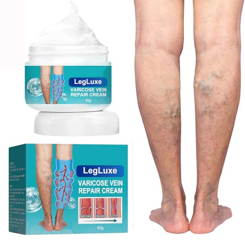 Grgowe Krampfadern Creme,Varicose Veins Cream,Creme Gegen Besenreiser,Venen Aktiv,Spider Veins,Krampfadern Und Besenreiser Entfernen,Lindert Beinschmerzen Und Schwellungen