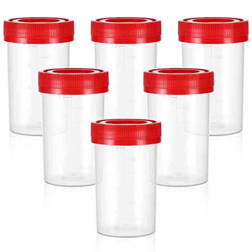 iplusmile 10 Stücke Urinbecher Probenbecher mit Deckel 60ML Urinprobenbecher Urin Röhrchen Urintassen Ovulationstest Becher Probenröhrchen für Schwangerschaftstest Labor Zufällige Farbe