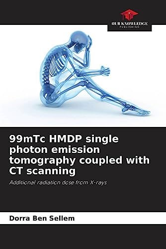 99mTc HMDP single photon emission tomography coupled with CT scanning: Additional radiation dose from X-rays