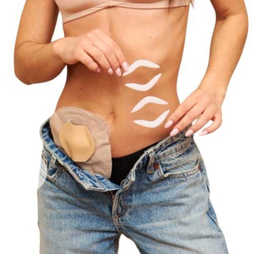 SIIL Ostomy Shield | Stoma Guard | Ostomy Protector Ostomy | Ostomiezubehör | Ostomiebeutelabdeckung | Beige