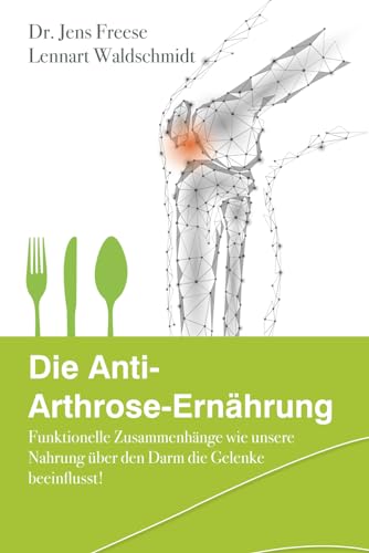 Die Anti-Arthrose-Ernährung: Funktionelle Zusammenhänge wie unsere Nahrung über den Darm unsere Gelenke beeinflusst!