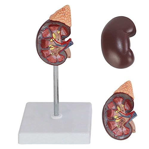 Lehrmodell, Pathologie, Nierenanatomie-Modell mit normaler und kranker Anatomie, menschliches Nieren-anatomisches Modell für Lehrmodelle, Display-Desktop-Ornamente