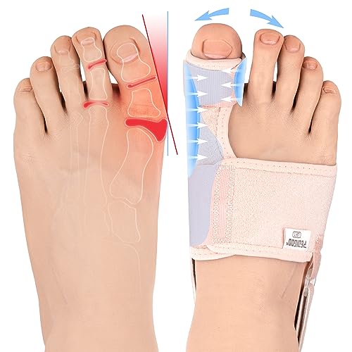 PEDIGOO Hallux Valgus Korrektor für Frauen, 2 Stück, rutschfester Bunion Zehenspreizer, Entlastung bei Hallux Valgus für Tag/Nacht Unterstützung