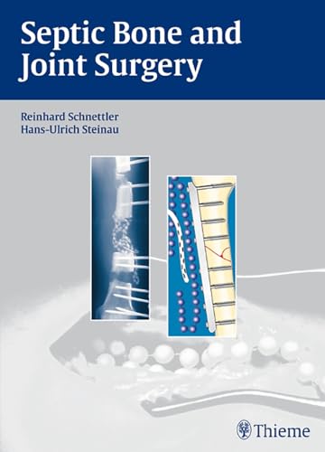 Septic Bone and Joint Surgery