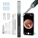 Ohrenschmalz Entferner Otoskop, VITCOCO 1920P Wifi Ohrreiniger, IP67 Wasserdicht Otoskop Ohr, 360°-Weitwinkel Otoskop Kamera mit 6 LEDs für Erwachsene, Kinder und Haustier (Schwarz)