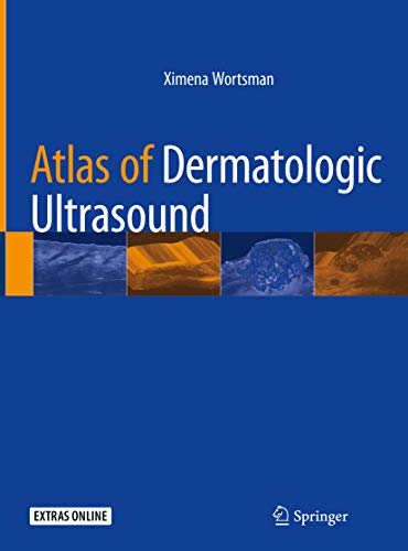 Atlas of Dermatologic Ultrasound (English Edition)