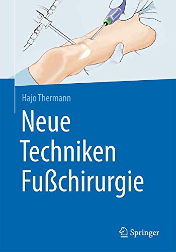 Neue Techniken Fußchirurgie