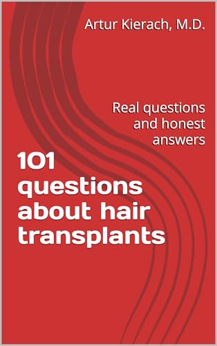 101 questions about hair transplants (English Edition)