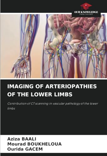 IMAGING OF ARTERIOPATHIES OF THE LOWER LIMBS: Contribution of CT scanning in vascular pathology of the lower limbs