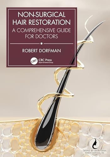 Non-surgical Hair Restoration: A Comprehensive Guide for Doctors