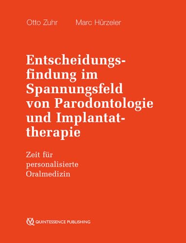 Entscheidungsfindung im Spannungsfeld von Parodontologie und Implantattherapie: Zeit für personalisierte Oralmedizin