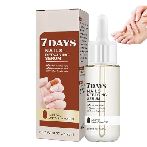 7 Days Nail Growth and Strengthening Serum, Nagelserum für Stärke und Wachstum, Nail Repair Essence Serum - Nagelöl für Fuß & Fingernägel, stärkt pflegt rissige brüchige Nägel