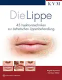 Die Lippe: 45 Injektionstechniken zur ästhetischen Lippenbehandlung