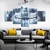 Leinwandbild 5 Tlg. Zahnröntgen Druck Auf Leinwand Bild Kunstdruck 100×55 Cm Für Wohnzimmer Hotel Restaurant Büro Home Decor Poster Wandkunst Wandbild -1L4C+M9G