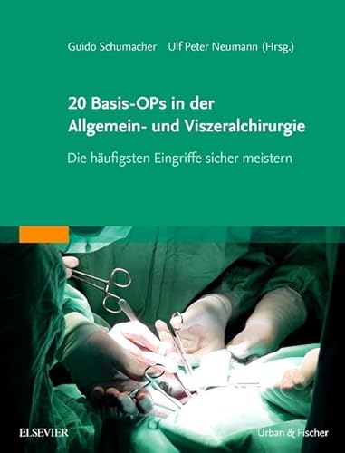 20 Basis-OPs in der Allgemein- und Viszeralchirurgie: Die häufigsten Eingriffe sicher meistern