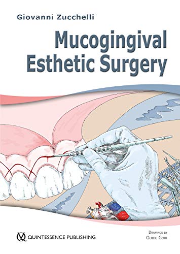 Mucogingival Esthetic Surgery