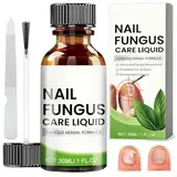 Nagelpflege für Fußnägel, Nail Repair, Schutz & Stärkung brüchiger Nägel, Nagelpflege Pflegend, Nagelpflegeöl, Nail Care, Fußnägel Behandlung mit Nagelfeile, 30ml