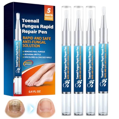 4 Stück Nagelpflegestift,Nagelaufbauserum,Nagelpflegeprodukte,Nägel Reparieren,Nägel nähren Nail Care Pen,Nail Care Renewal & Recovery Liquid für Dicke, Beschädigte & Verfärbte Nägel