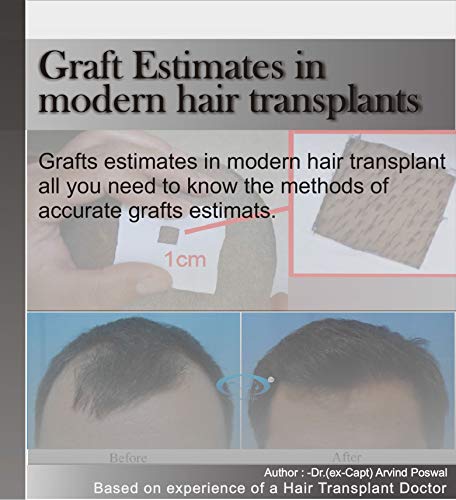 Graft Estimates in modern hair transplants: All you need to know about the methods of accurate hair graft estimates for yourself (English Edition)