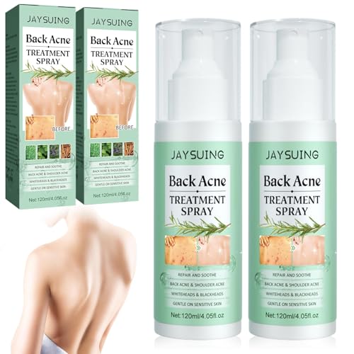 2 Stück Akne Rücken Spray, Akne Komplex Spray, Back Acne Treatment Spray, Rücken-Peeling Tiefenreinigung, Behandlung von Rückenakne, Natürlich, sanft zur Haut