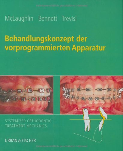 Behandlungskonzept der vorprogrammierten Apparatur: Systematisierte Straight-Wire-Technik