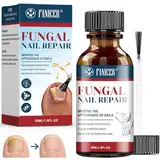 30ml Nagelaufbauserum,Mit Reibstreifen und Bürsten,Nagelpflege pflegend,NägelReparatur für pflegt rissige,NägelReparatur,Nagelhautpflege für Gebrochene und Verfärbte Nägel