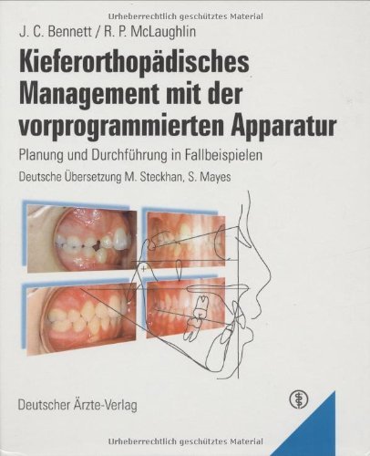 Kieferorthopädisches Management mit der vorprogrammierten Apparatur: Planung und Durchführung in Fallbeispielen