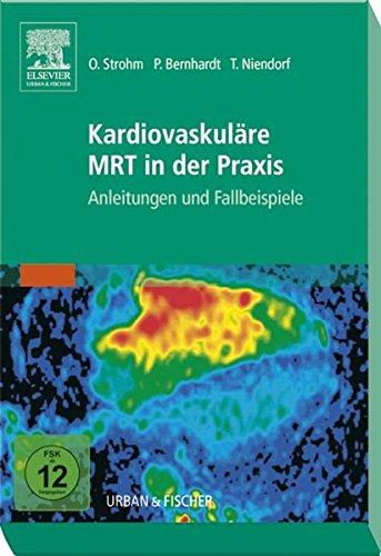 Kardiovaskuläre MRT in der Praxis: Anleitungen und Fallbeispiele