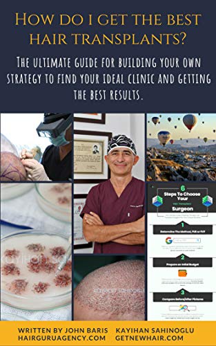 How Do I Get The Best Hair Transplants?: The Ultimate Guide For Building Your Own Strategy To Get The Best Transplants (English Edition)