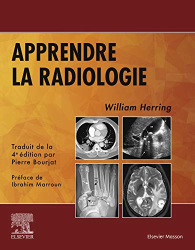 Apprendre la radiologie (Hors collection) (French Edition)